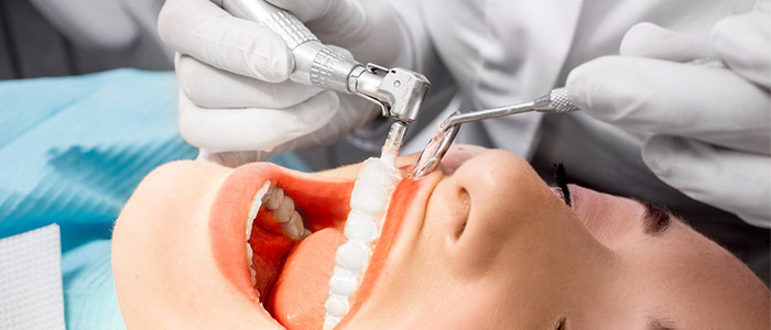 What You Should Know About Recovery after Wisdom Teeth Extraction